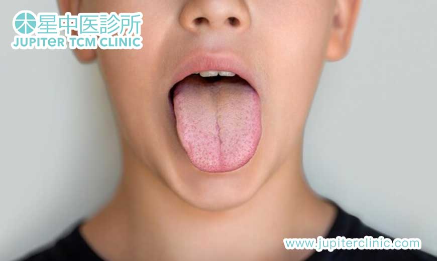舌頭怕熱脷苔白的中醫對策：從飲食到生活習慣，一文掌握！