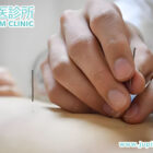 擺脫運動傷痛、重拾巔峰表現：木星中醫診所「運動醫學針灸」深度剖析