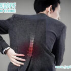 久坐或突發閃腰腳麻痺？「腰椎間盤突出」的中醫內外兼治方案