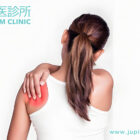 舉手都痛？「肩周炎」唔只係五十歲嘅事！木星中醫教你擺脫「冰封膊頭」！