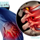 腰痛、坐骨神經痛分不清？中醫解構「腰椎大陣」受損成因及對症根治方案！