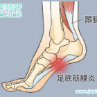 擺脫「腳板似針拮」的惡夢：中醫如何精準治療足底筋膜炎？