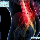 坐骨神經痛發作！「針刺」和「電擊」般痛楚點算好？木星中醫助你循經止痛，告別長坐長痛！