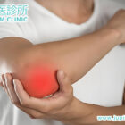 肘部疼痛久治不癒？高爾夫球肘、網球肘，木星中醫為您找出「根源」！