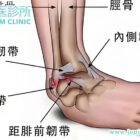 高爾夫愛好者注意！腳踝扭傷不容忽視，香港木星中醫為您精準復位、加速重返球場！