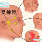 面痛如電擊？中醫助您擺脫「天下第一痛」——三叉神經痛！