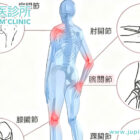告別手腕腳踝的「隱形炸彈」：從中醫角度根治肌腱炎、腱鞘炎，重拾無痛生活！