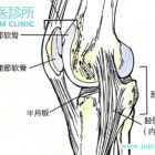 膝蓋疼痛，腳步卡卡？中醫為您深度解析半月板撕裂與治療之道！