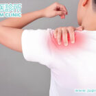 肩痛如刀割、晚間痛醒？中醫如何助你「溶解」鈣化性肌腱炎！