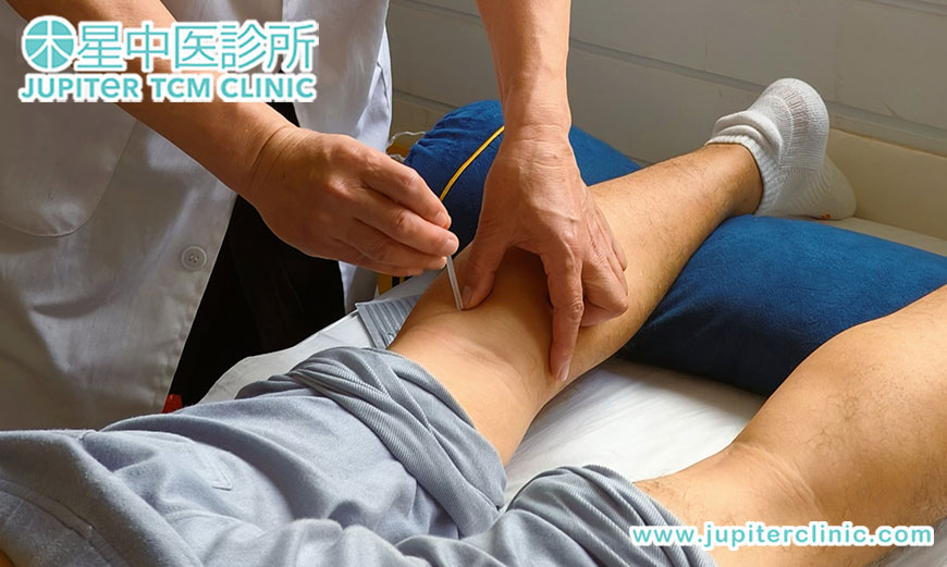 告別「只冰敷」的年代！香港木星中醫診所：中西醫結合，教您從根本修復筋骨損傷，杜絕慢性痛