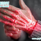 終結免疫風濕病——從根源調控，重啟無痛人生