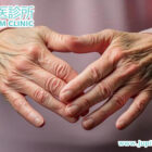 擺脫類風濕性關節炎的「無情折磨」：中醫「痺證」治療，由內而外重建關節健康