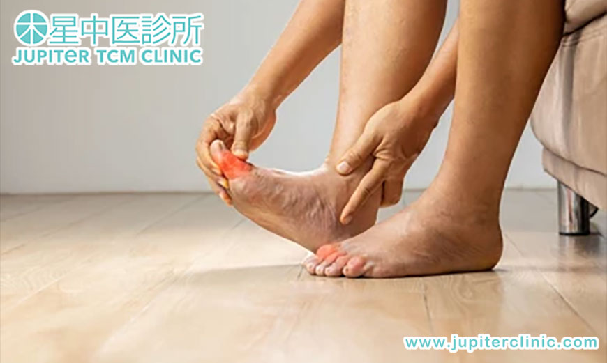 告別痛風魔咒：木星中醫為您揭示「痹證」的深層調理與根治之道