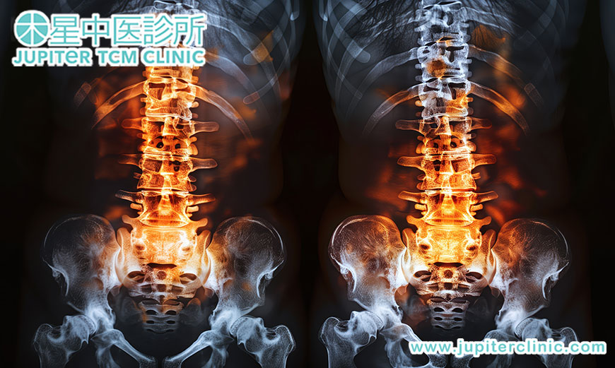 腰椎滑脫不再怕！從根源調理，告別纏人腰痛與腿麻