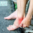 腳踝扭傷不能等！木星中醫診所教您：從根源徹底治癒，告別「慣性拗柴」！