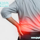 中醫如何為僵直性脊椎炎患者重塑平衡，告別晨僵之苦？