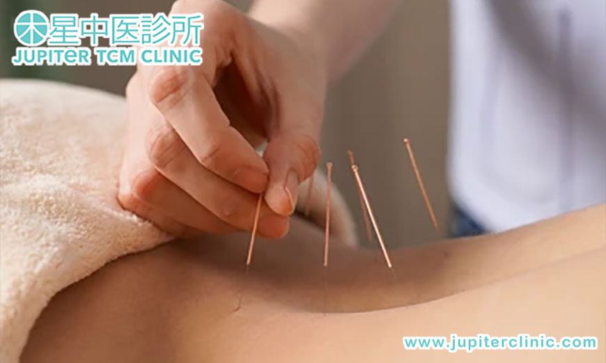 告別十年頑固痛症！「圓針治療」，讓您重獲無痛人生！