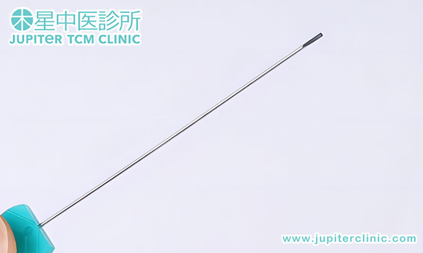 告別頑固痛症，重拾無痛人生——中醫「小針刀」微創精準療法