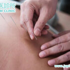 中醫傷科整體調理，助您解除筋骨枷鎖！