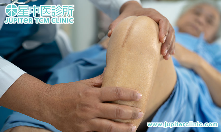 告別術後疼痛困擾，中醫針灸助您加速康復、重拾活力！