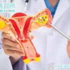 擺脫「女人不能說的痛」!木星中醫:專業調理盆腔炎,守護您的子宮健康