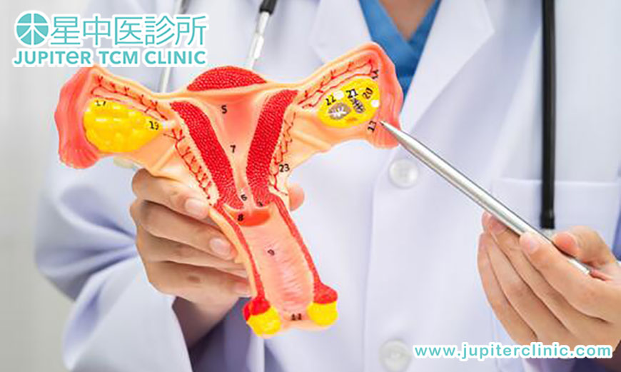 擺脫「女人不能說的痛」！木星中醫：專業調理盆腔炎，守護您的子宮健康