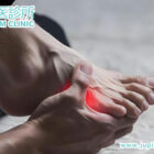 手腳麻痺不再是小事!中醫調理神經病變,從根源活血通絡,重獲自在人生