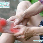 告別「腳底之苦」:中醫調理足跟痛,重拾自在步履